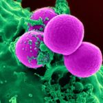 Cellule Kamikaze contro i tumori